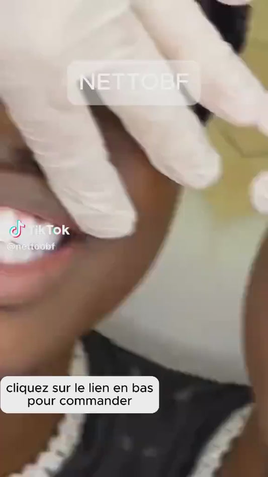 LE GEL DE BLANCHIMENT GLORY SMILE